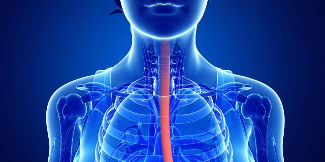 Divertículo de Zenker