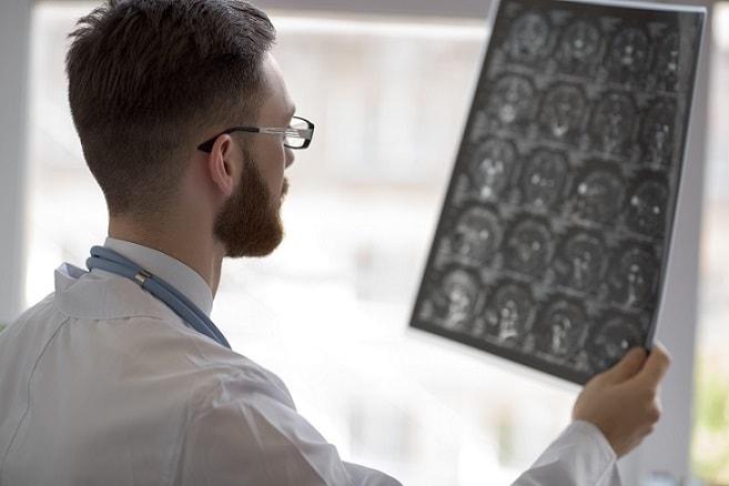 médico avaliando exame neurológico para identificar a diferença entre status cognitivo e patologia
