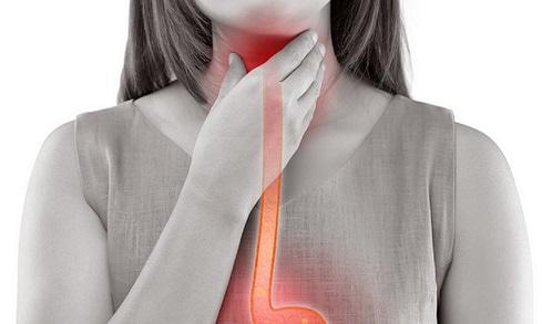 Representação gráfica de mulher sofrendo com esofagite eosinofílica