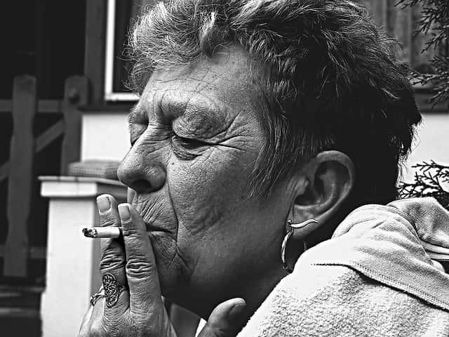 Mulher de 72 anos, hipertensa, tabagista de 60 maços/ano, foi admitida no serviço de neurologia, há 5 semanas com queixa de parestesia progressiva nas extremidades e dificuldade na marcha.