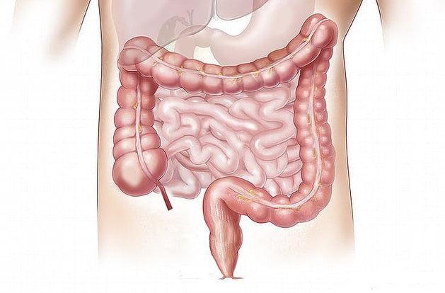 Congresso virtual trata de doenças inflamatórias intestinais.