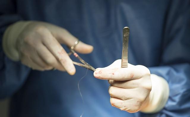 médico cirurgião fazendo cirurgia para acalasia