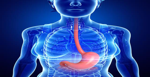 Esôfago curto: Estudo revisa questões históricas e atuais relacionadas ao seu tratamento
