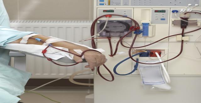 Pesquisa monitora pressão intracraniana antes e depois das sessões de hemodiálise utilizando método não invasivo