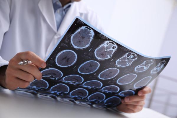 Esclerose múltipla: orientações para planejamento familiar