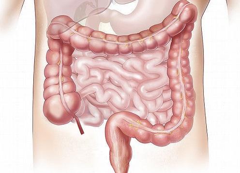 O eixo intestino-coração e as doenças cardiovasculares