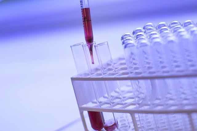 Jejum de 12h para exames de colesterol não é mais obrigatório
