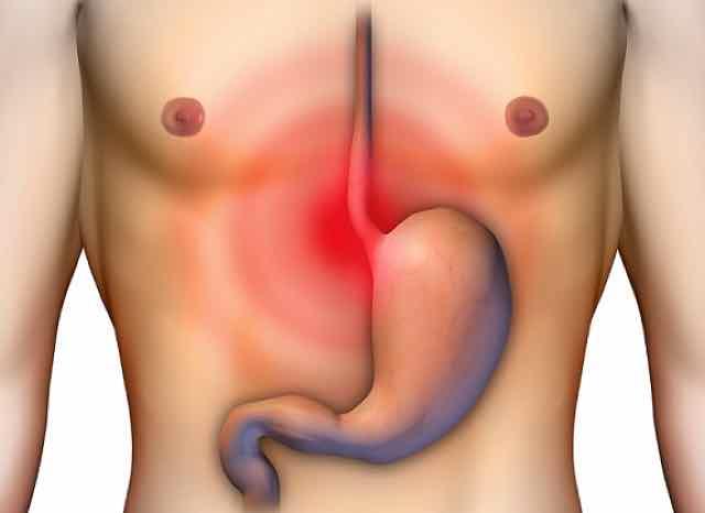 Veja as novas recomendações para abordagem e tratamento do sangramento por varizes gastroesofageanas