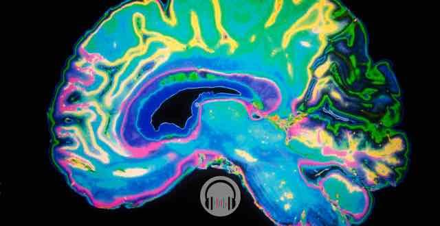 cerebro com sangramento