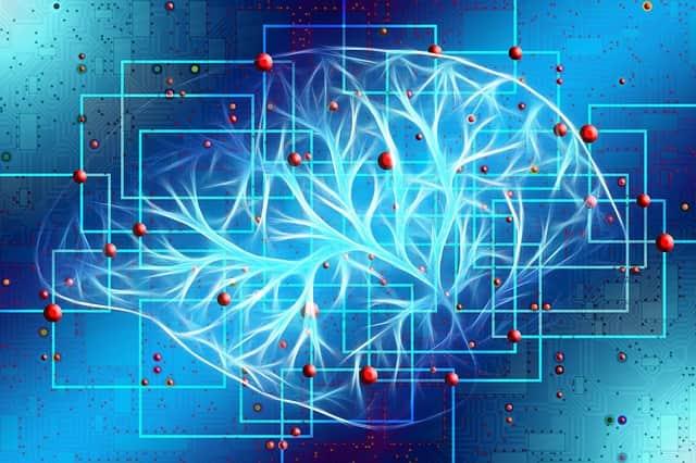 cerebro