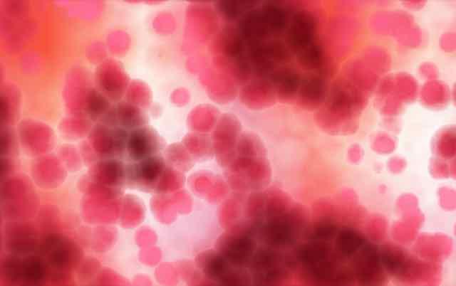 Uso do ferro em dias alternados é melhor que diário em mulheres com anemia ferropriva?