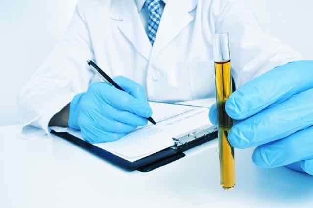 médico segurando um exame de urina