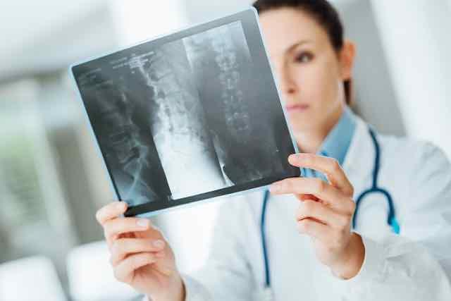médica examinando raio x de paciente