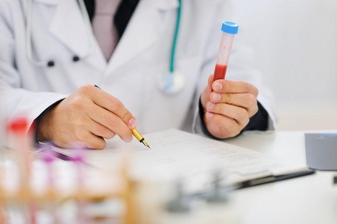 médico laboratorista avaliando LDL-c em sangue