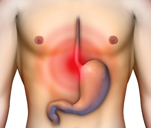 Mecanismos fisiológicos da acidez gástrica e consequências da hipersecreção ácida