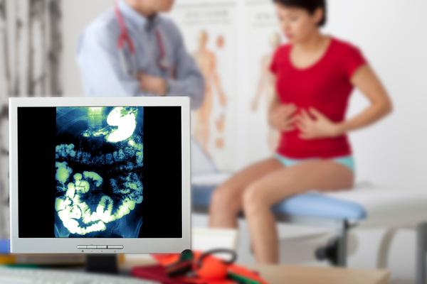 doenças inflamatórias intestinais