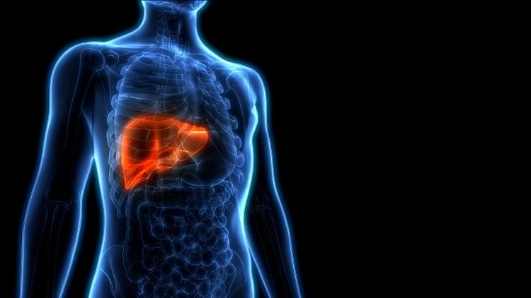 Quais são os preditores de sobrevida pós transplante hepático do paciente com NAFLD?