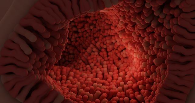 Colonoscopia é eficaz em prevenir mortalidade por câncer colorretal