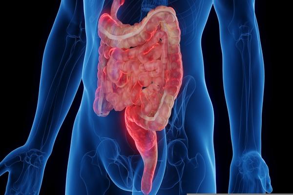 Novas diretrizes brasileiras de doença de Crohn