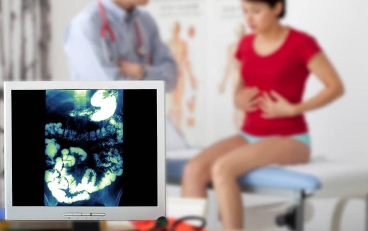síndrome do intestino irritável