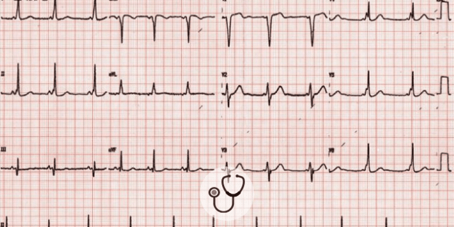 Caso clínico: paciente pode ser liberada para realizar atividades físicas?