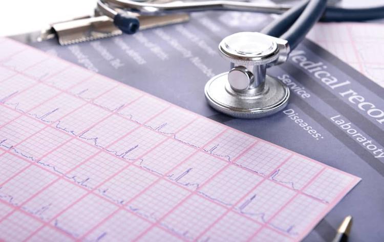 troponina ultrassensível