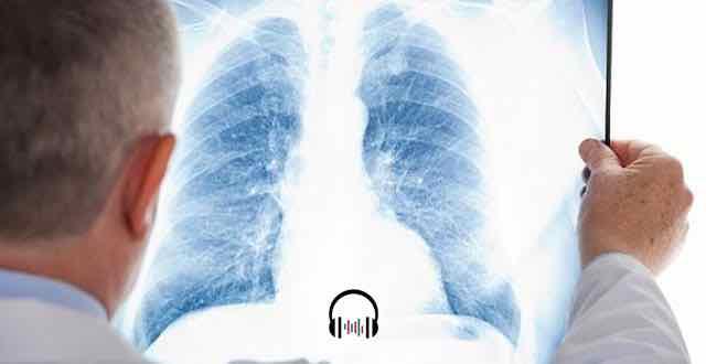 medico olhando uma radiografia do torax