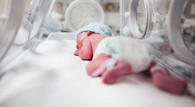 bebe na incubadora com sifilis congenita