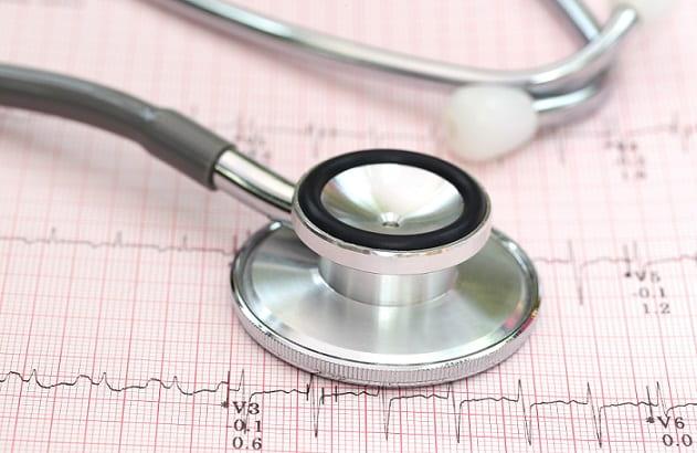 eletrocardiograma apresentando repolarização precoce com um estetoscópio em cima