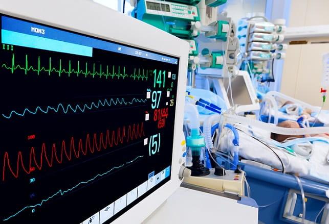 monitor de ecg em unidade de terapia intensiva
