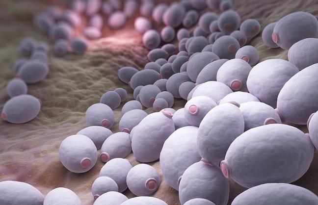 imagem digital de candidíase vulvovaginal recorrente