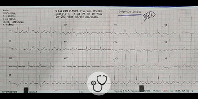 Caso clínico - Paciente 15 anos