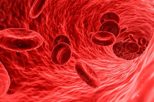 Anemia megaloblástica e suas alterações morfológicas