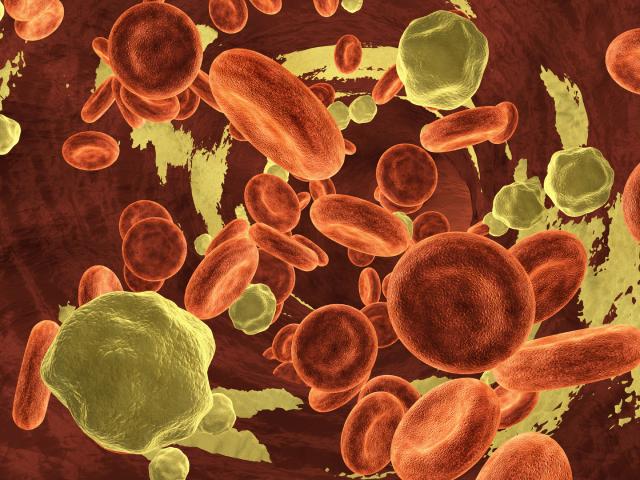 O uso de ferro por via intravenosa para o tratamento de anemia ferropênica é recomendado em muitas diretrizes clínicas devido à sua eficácia.