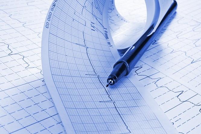 mavacamtem para miocardiopatia hipertrófica