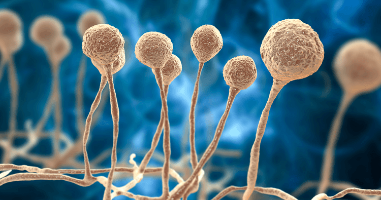 Tinea cruris: sintomas, diagnósticos diferenciais e tratamento