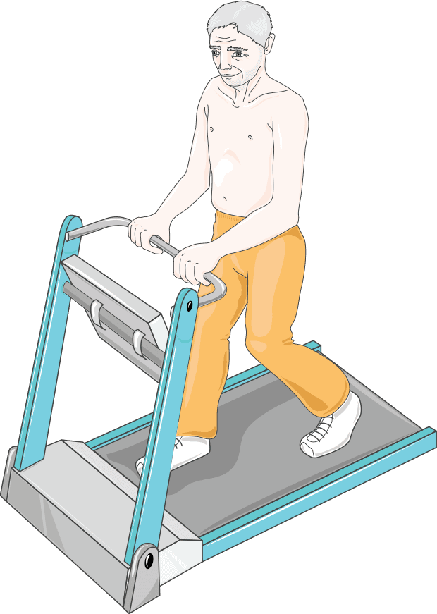 Nueva directriz de cardiología del deporte: ¿cuándo pedir prueba ergométrica?