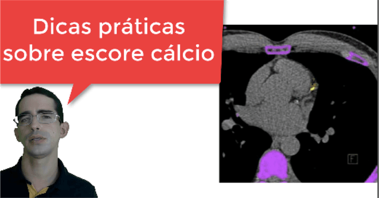 Dicas práticas sobre escore cálcio