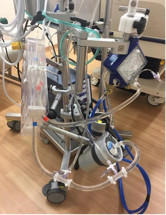 Afinal, ECMO reduz mortalidade ou não no choque cardiogênico?