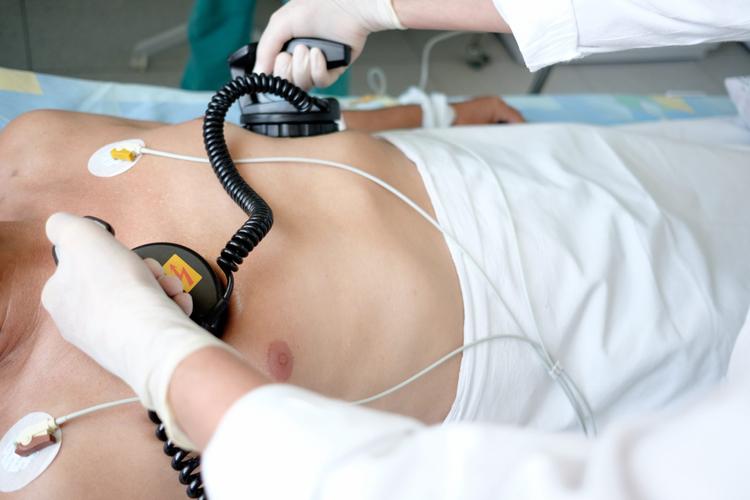 Inteligência Artificial pode prever Fibrilação Ventricular Refratária?