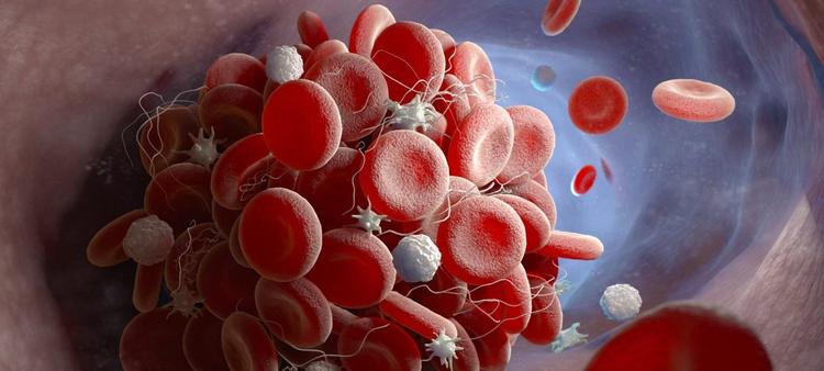 Anticoagulantes reduzem o risco de eventos trombóticos arteriais no câncer?