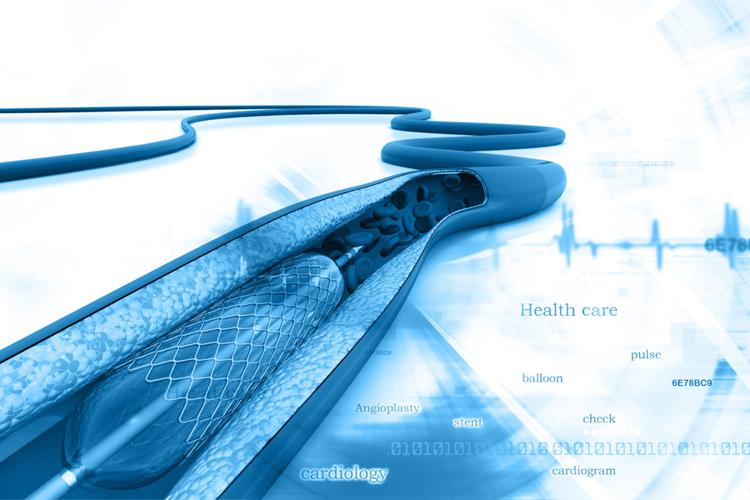 Angioplastia não serve de nada em pacientes com coronariopatia crônica?