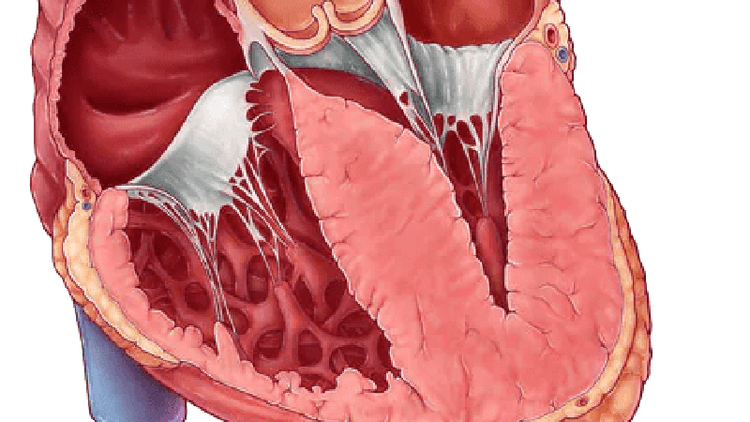 Qual a história natural da miocardiopatia hipertrófica?