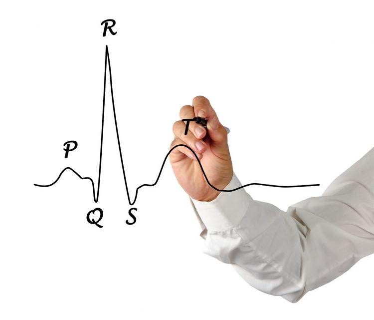 Como entender eletrocardiograma de uma forma simples?