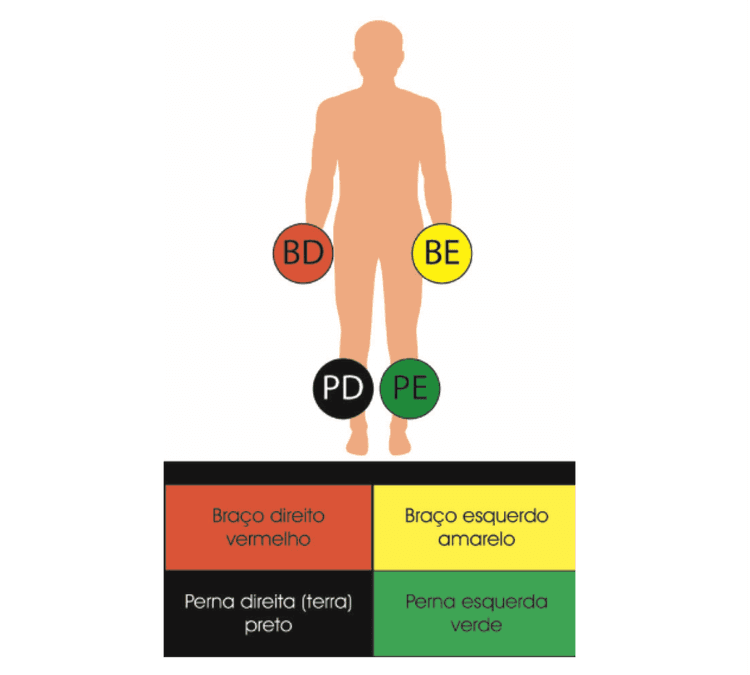 Você sabe colocar os eletrodos do ECG de forma correta? Tem certeza?