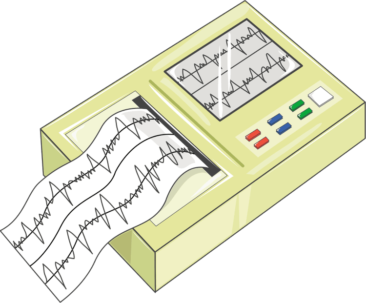 Pré-Excitação Ventricular em Paciente Assintomático: O Que Fazer?