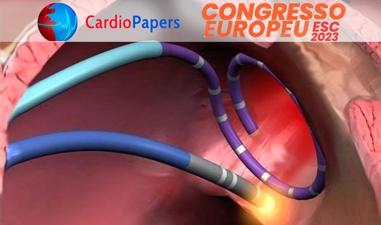 Ablação é a solução para fibrilação atrial em pacientes com ICFEr terminal?