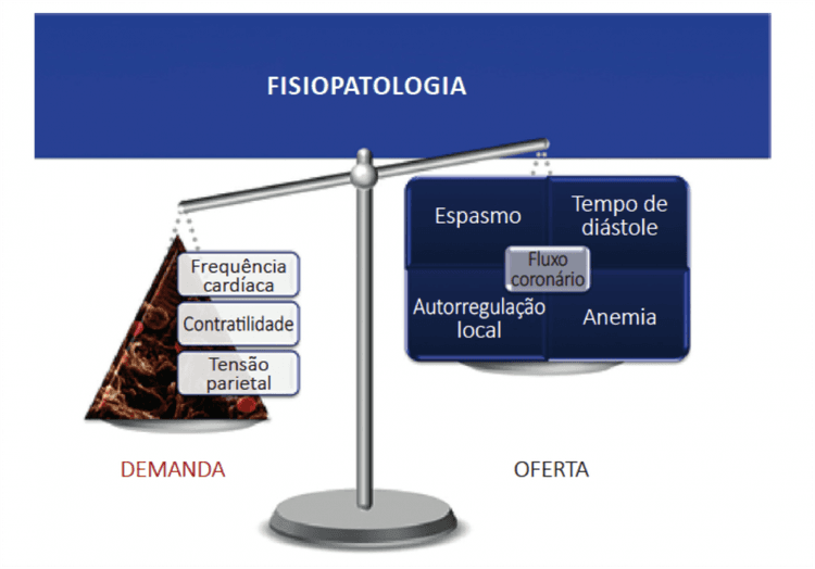 Troponina aumentada = diagnóstico de infarto? Não!!!