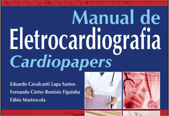 Como diferenciar uma taquicardia de QRS largo usando apenas a derivação DII?