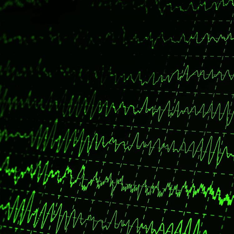 Como memorizar as principais drogas que aumentam intervalo QT?